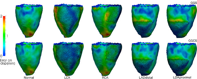 DisplacementError3DIschemicNoPc.jpg